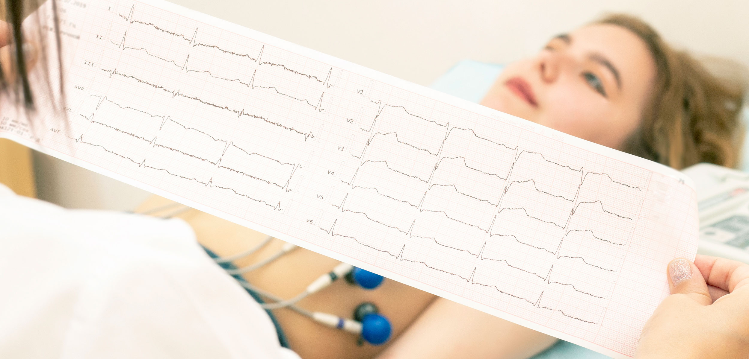 electrocardiograma rancagua