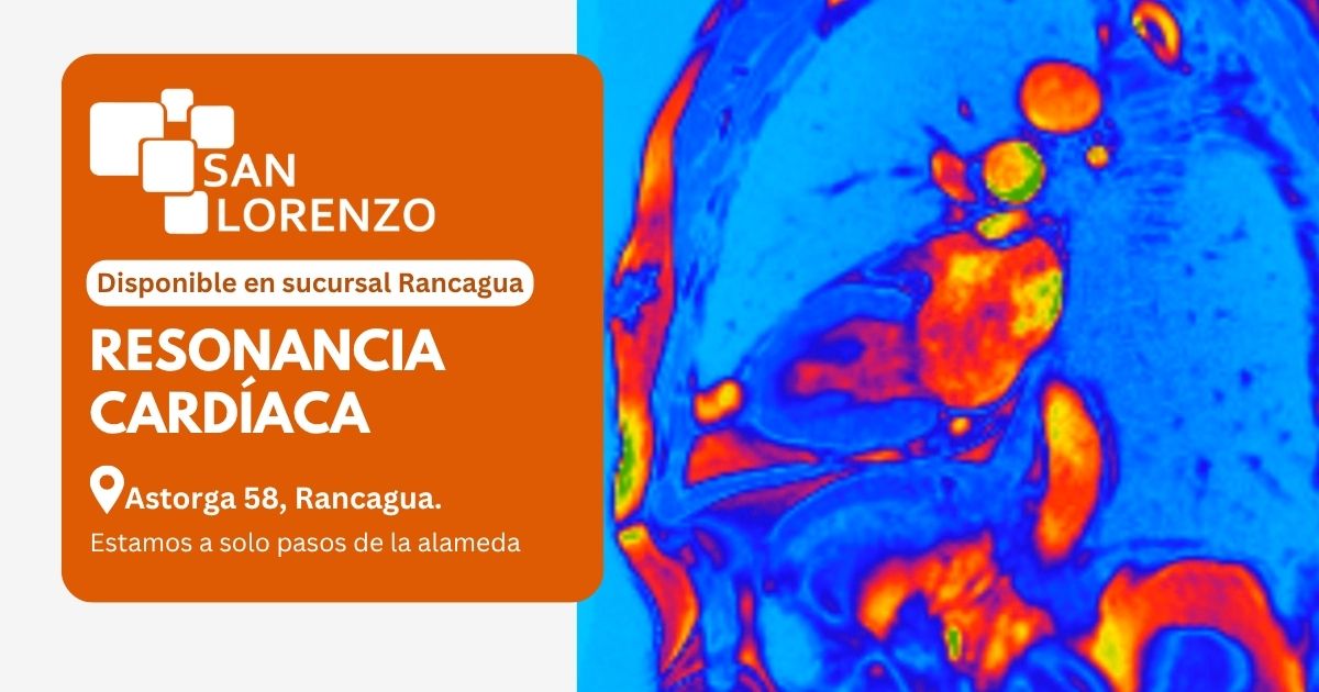Resonancia magnética cardíaca en Centro de Diagnóstico San Lorenzo, Rancagua