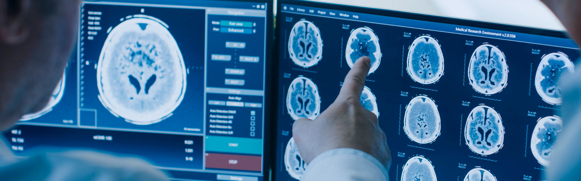 Exámenes oncológico rancagua